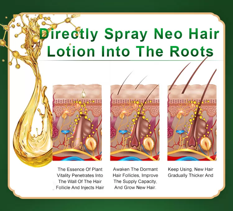 رذاذ مكافحة تساقط الشعر 2