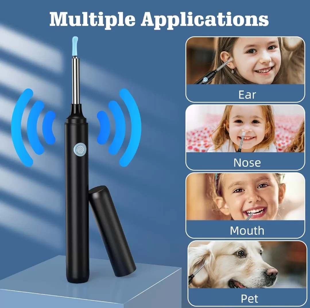 منظار الأذن