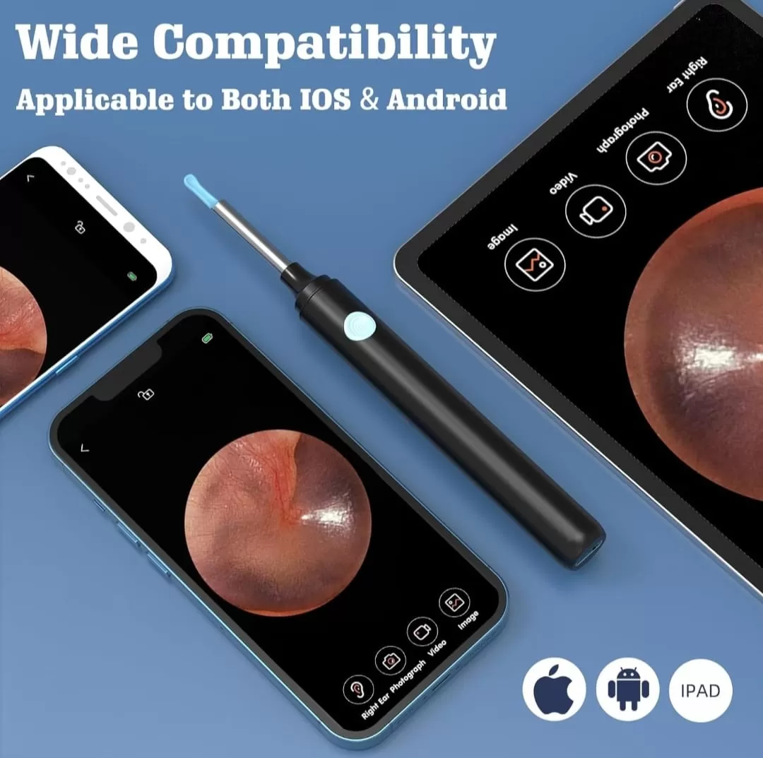 منظار الأذن 2