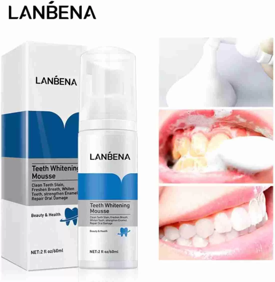 فوم تبيض الأسنان 2